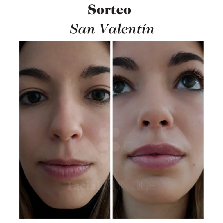 SORTEO BESOS SAN VALENTÍN